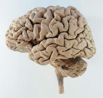 154 UNIT 3 COORDINATION Figure 9.9 A side view of a human brain. Notice the folded surface of the cerebral cortex.