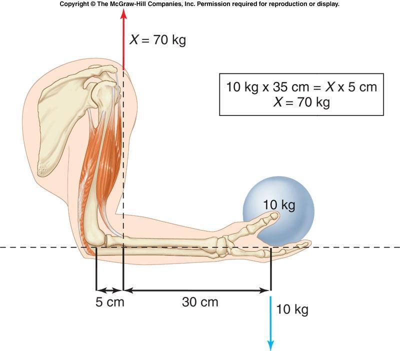 The lever system of muscles and bones: Here, muscle contraction must generate 70 kg