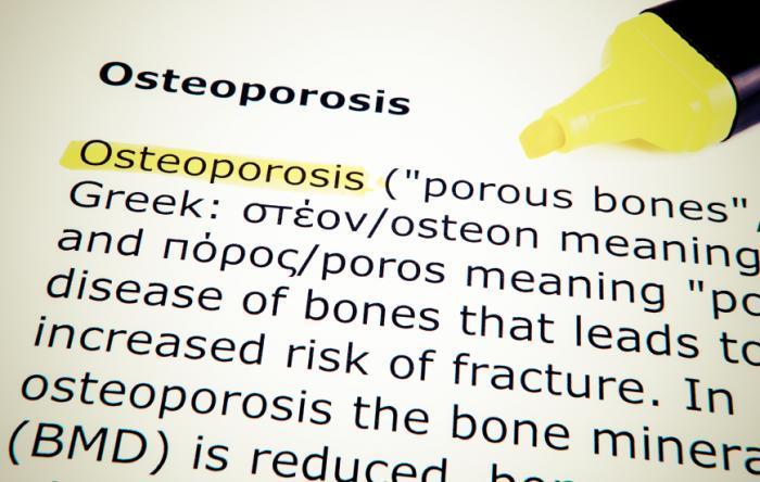 Osteoporosis is a disease characterized by low bone mass and deterioration of bone tissue.