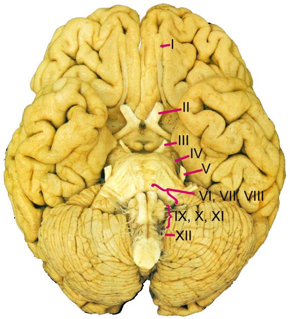 Hypoglossal Nerve (CN XII) General motor to the