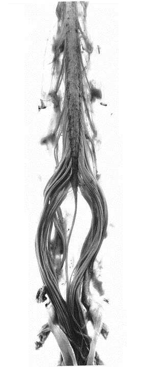 Conus Medullaris Caudal end of spinal cord Cauda Equina (L1-L5, S1-S5, Co1) Filum