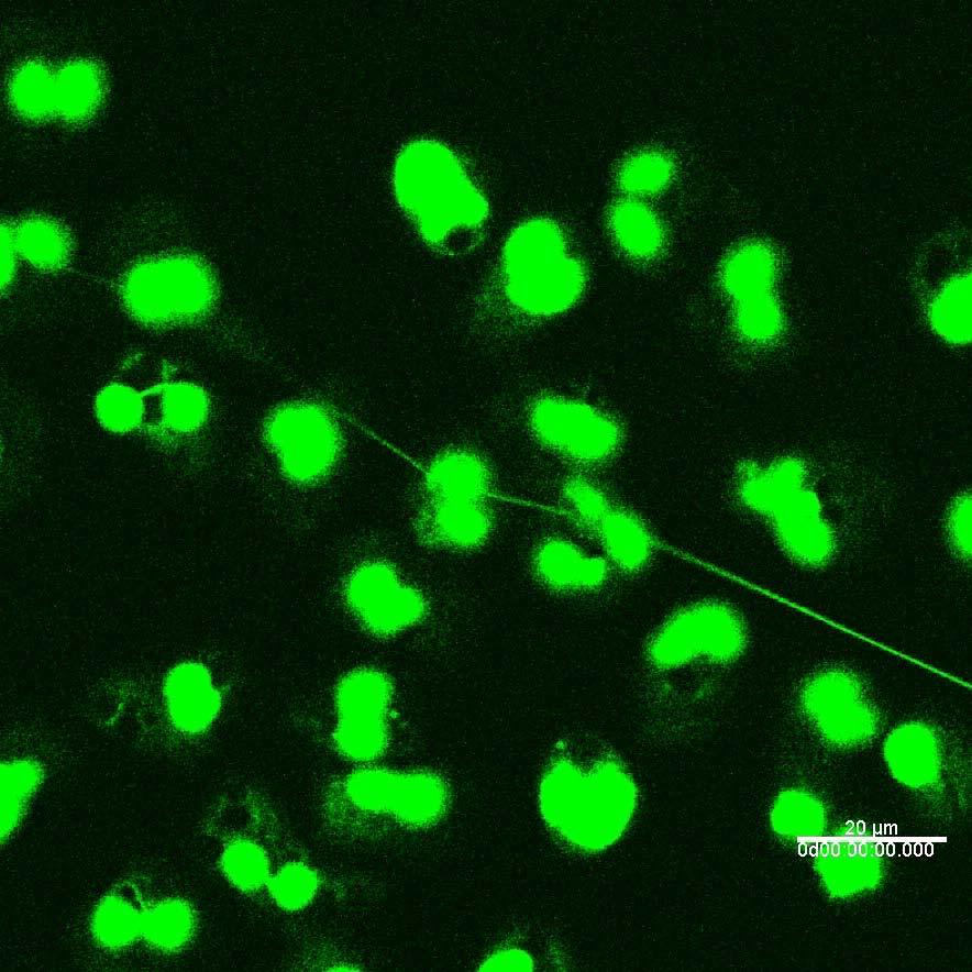 Purified eosinophils DNA Time-lapse video microscopy Supplementary Movie 5 online.