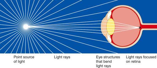 brain Lens refracts light to