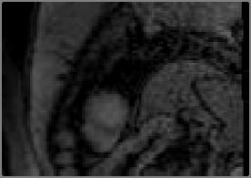 Contrast-Enhanced MRI of Myocardium Recent Advances (Sharif B