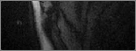 image series) Stress 6-slice Radial Scan; (apical to basal