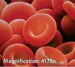 Red Blood Cells - Erythrocytes 44% of total blood volume Contain hemoglobin for oxygen transport 280 million hemoglobin in each red blood cell Also carry small