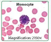 phagocyte