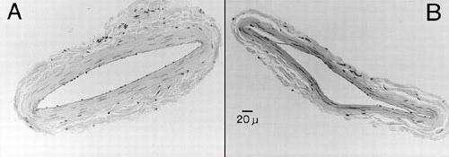 Blood Vessel Changes in Rats Results A and C are