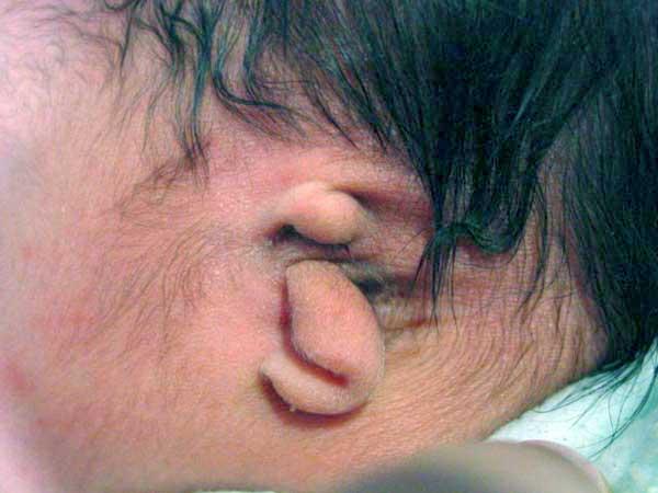 Deformity: Congenital- minor to extensive May indicate other organ malformations