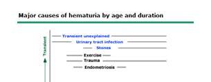 Major Causes of Hematuria by Age and Duration Causes of Hematuria 9-15% of normal people have benign transient