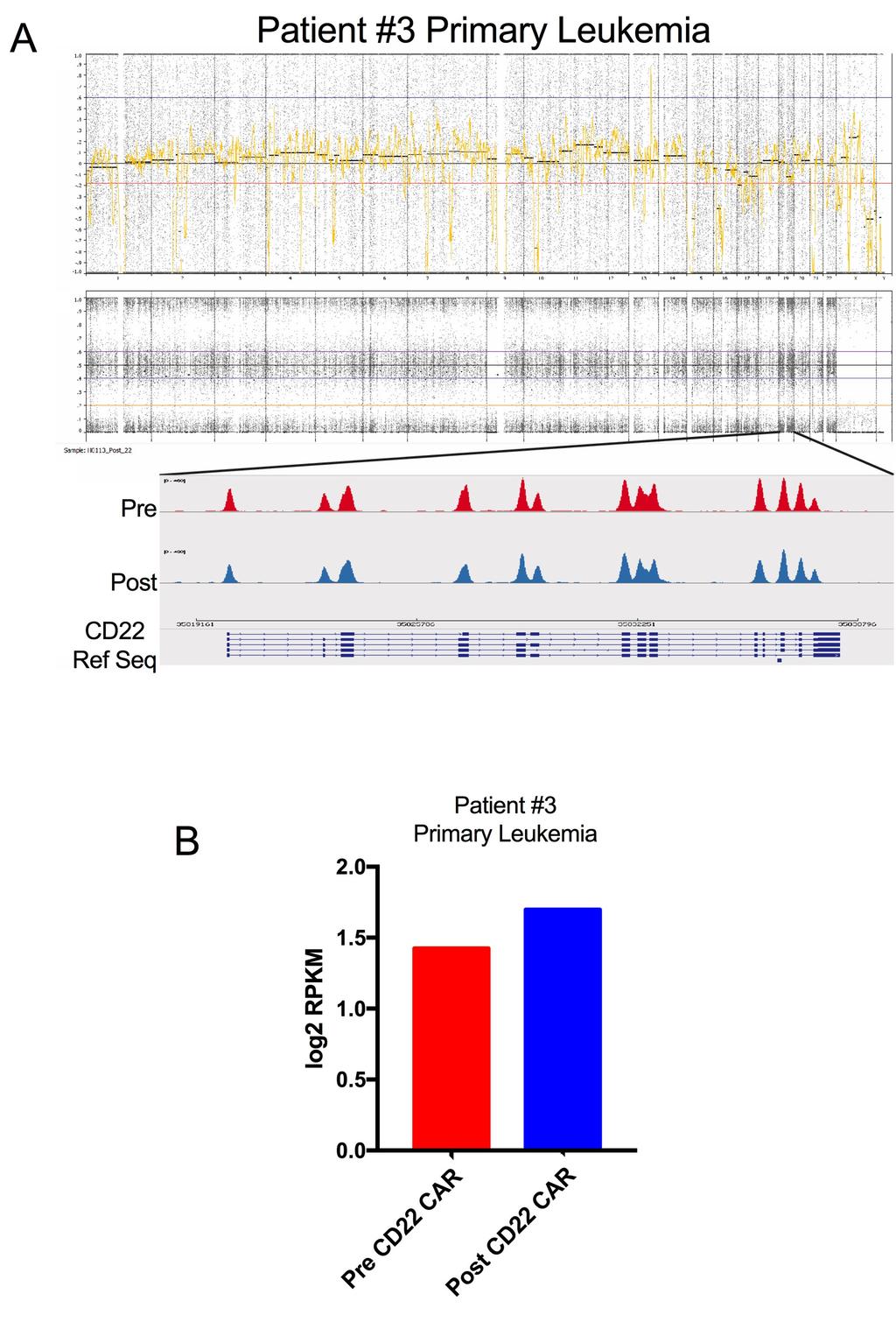 Supplemental Figure 4. Whole Exome and RNAseq profiling of CD22 in Primary Patient Sample recurring in the presence of CD22 CAR Immune Pressure.