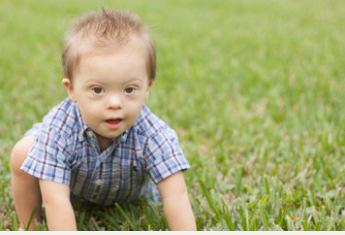 DOWN SYNDROME BEHAVIORAL PHENOTYPE Relative strengths: Receptive Language Visual processing Social Relatedness* Relative