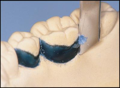 Whenever possible, cast should be surveyed with the occlusal plane parallel to the base of the
