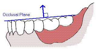 Displacing forces are directed at nearly 90 angle to the occlusal plane. Displacing forces are generated as a direct effect of consumed sticky foodstuff.