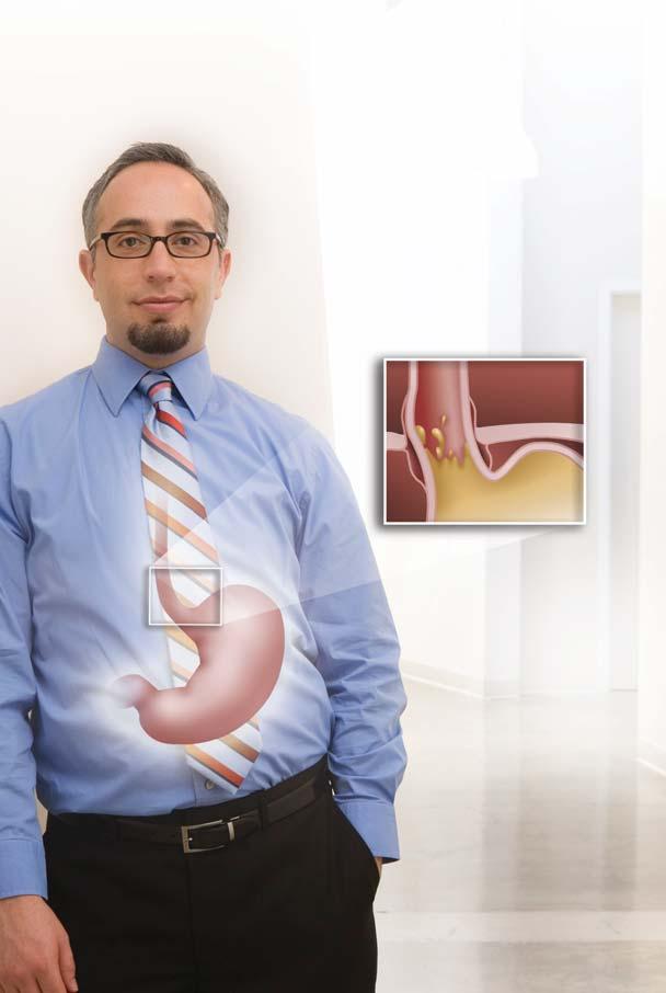 Doctors call it gastroesophageal reflux disease, or GERD. Millions of Americans call it heartburn. Many more also have coughing, wheezing, or hoarseness without realizing GERD is to blame.