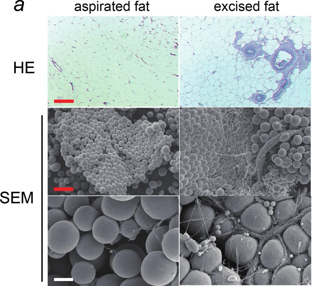 CELL-ASSISTED LIPOTRANSFER A aspirated fat 3377 excised fat A B HE fat mass [mg] 1000 800 600 n=10 400 n=11 200 0 non-cal SEM B ASC yeield from suctioned fat / ASC yield from whole fat C non-cal fat