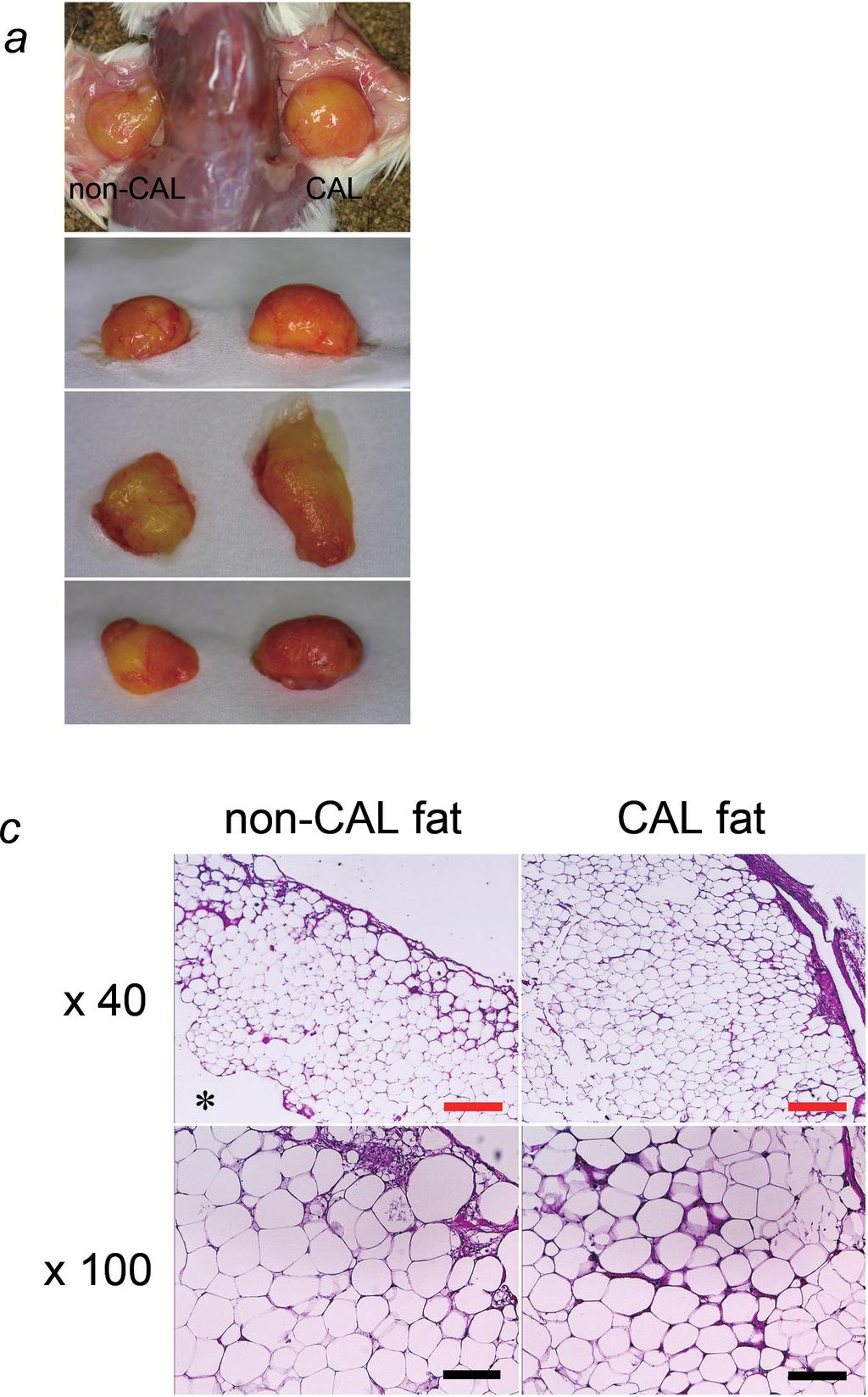 The basic structure of adipose tissue was preserved in the aspirated fat, while vascular vessels, especially large one, were significantly less detected in aspirated fat than in excised fat.
