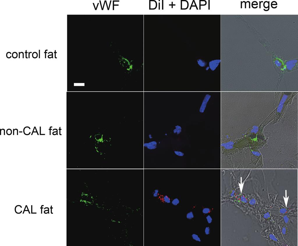 In CAL fat, DiI-labeled cells, which are supposed to be co-transplanted adipose-derived stromal (stem) cells, are located between mature adipocytes and in interstitial connective tissue.