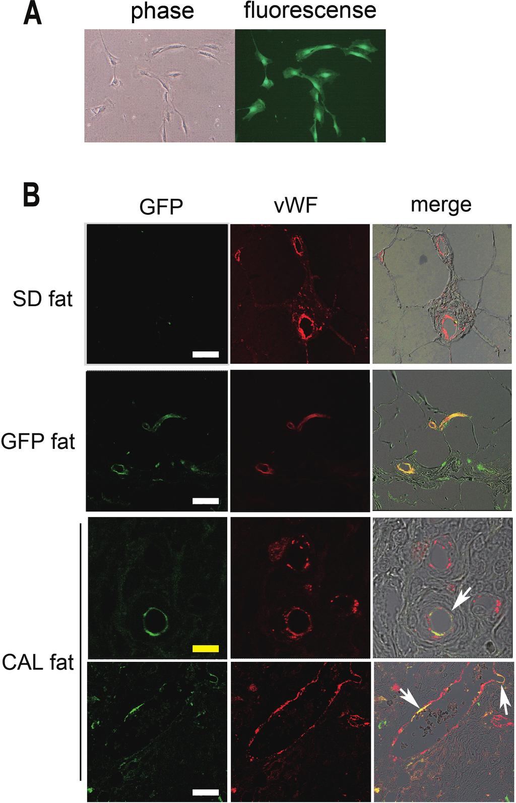 3380 FIG. 5. Cell-assisted lipotransfer (CAL) fat in rat models (fragmented fat of Sprague-Dawley [SD] rat and green fluorescent protein vascular stromal fractions [GFP-SVF rat]).