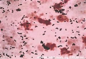 Streptococcus agalactiae Colonizes 15-40% of pregnant women J. Infect. Dis. 143: 761-766; 1981 Am. J. Obstet. Gynecol. 142: 617-620; 1982 J. Infect. Dis. 145: 794-799; 1982 J.