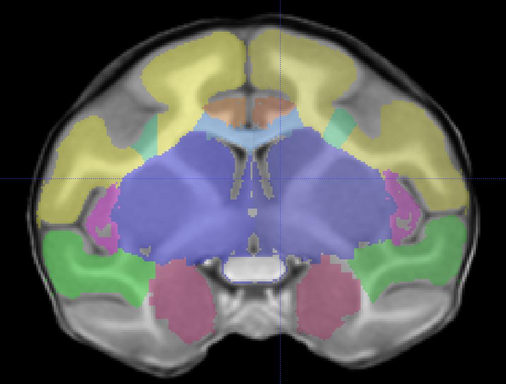 auditory temporal lobe is the point at which the superior temporal sulcus and sylvian fissure merge.