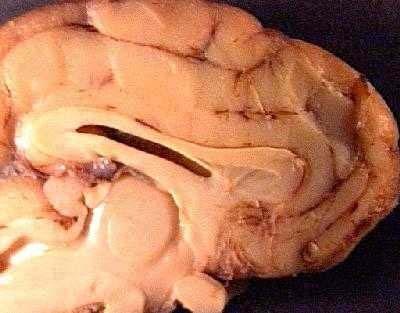 Sheep Brain Dissection Guide Page 11 10. This is a more detailed view of the mid-saggital section.