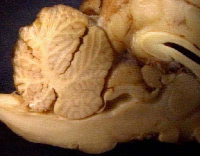 It is so big that different parts of it get different names. So you have the genu, splenium, and the body of the corpus callosum.
