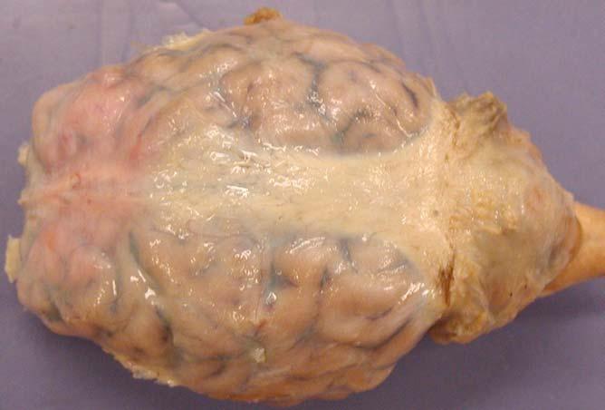 Sheep Brain Dissection Guide Page 4 Now on to the Dissection Proper.