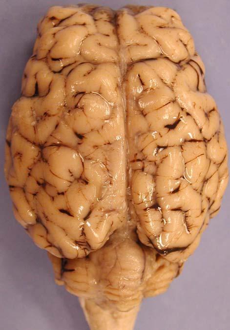 Sheep Brain Dissection Guide Page 9 8. Now find the four lobes of the cerebrum: frontal, parietal, temporal, and occipital.