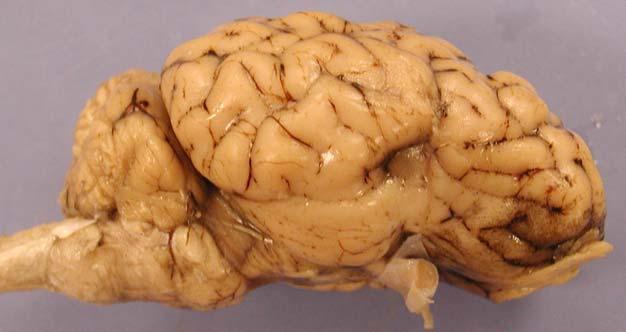 The Parietal Lobe is bounded by the Ansate Sulcus, the Suprasylvian Sulcus, and the Lateral Sulcus.