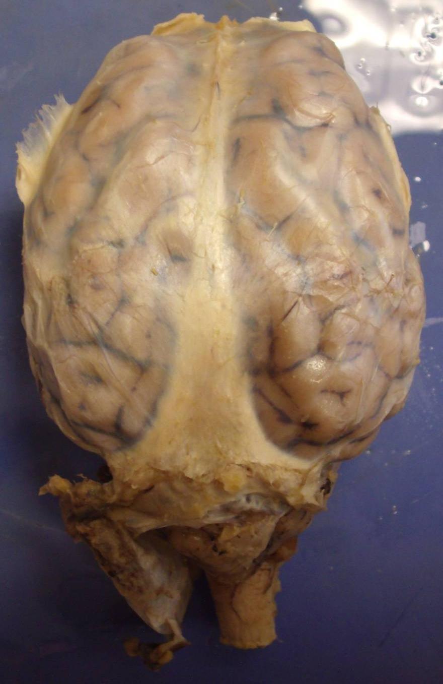 Dura Mater Sheep Brain (Superior