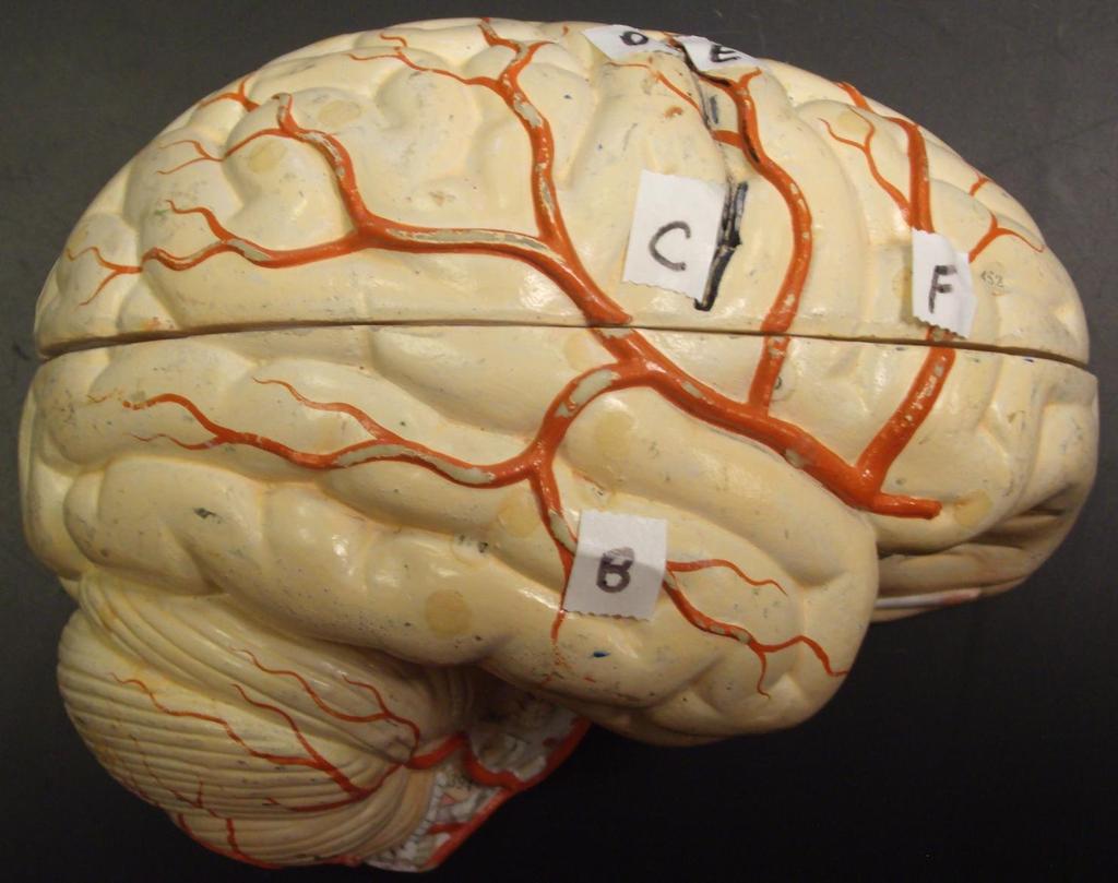 Brain from Torso Model 3-44 Parietal Lobe Primary Gustatory Area Primary Sensory Area (Postcentral Gyrus) Primary Motor