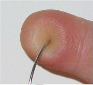 However, blunt suture needles are sharp enough to pierce muscle and fascia, but not sharp enough to pierce the skin.