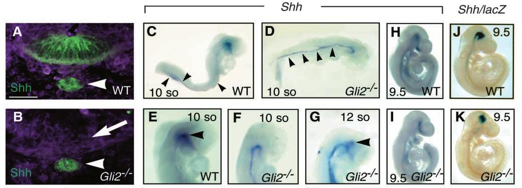 (C-I) Whole-mount RNA in situ for Shh at the somites (so) stage indicated or 9.5 dpc (9.5) in wild type (WT) and Gli2 / embryos.
