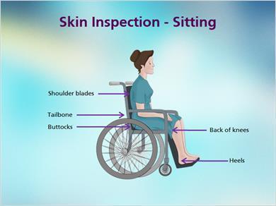 1.6 Skin Inspection 2 JILL: For those patient and residents in a sitting position, here are the key pressure points.