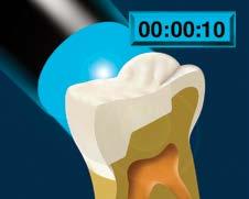 For curing lamps with less intensity (55 1 mw/cm ), the curing cycle is seconds on the occlusal surface.