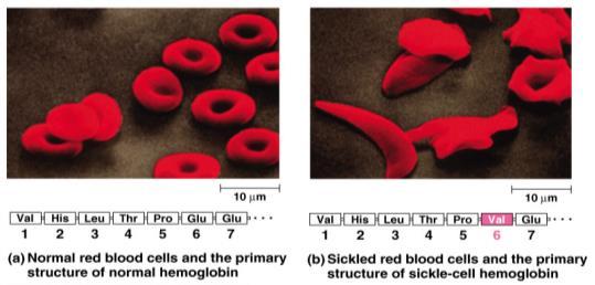 Sickle cell anemia Just 1 out of 146 amino acids!
