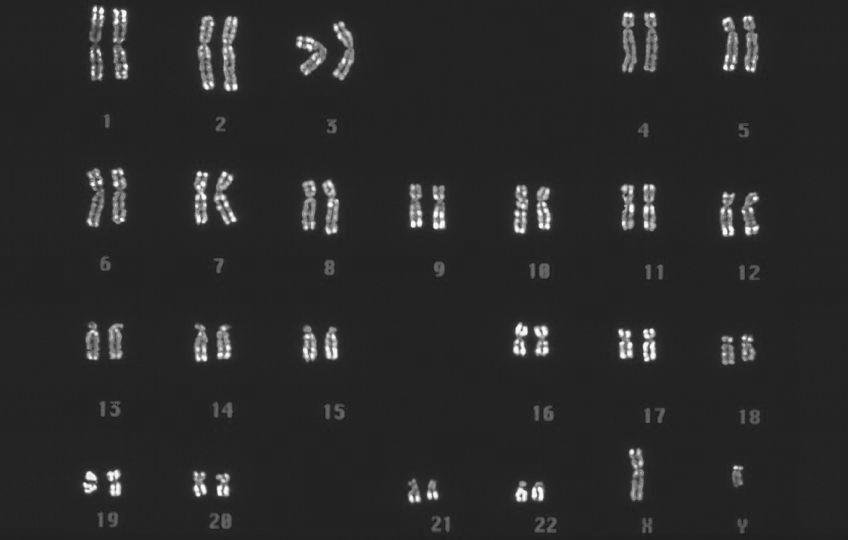 Nucleic cids human karyotype : a display of all the chromosomes of an individual.