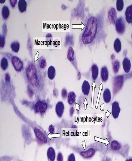 CELLS OF LYMPH NODE Lymphocytes Macrophages Plasma