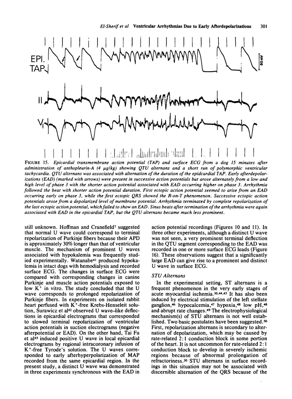 El-Sherifetal Ventricular An-hythmias Due to Early Afterdepolarizattons 301 mil 1. FIGURE 15.
