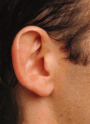 External ear o Auricle or pinna Skin-covered elastic