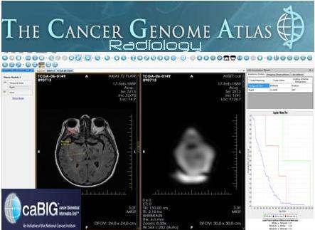 The cabig Cancer Genome Atlas Radiology Project Eliot Siegel, M.D.