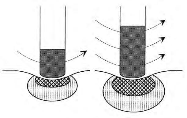 Conventional Electrodes: 4 mm vs 8 mm Tip 18 W 35 W* 60 60 4 mm Tip 8 mm Tip
