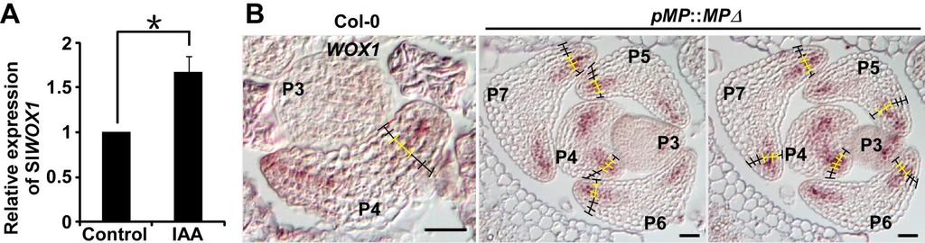Figure S3. Auxin induces WOX1 expression and the overexpression of MP promotes WOX1 adaxial expression. Related to Figure 3.