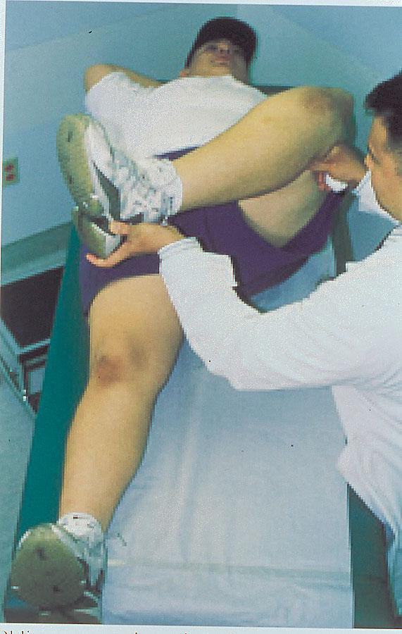 SCFE (clinical finding) Overweight teenager Pain hip, groin, thigh, knee Limited IR of hip Most consistent