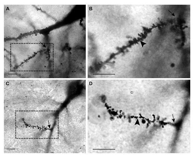 Note similarity to iron deficiency effects Dendrites