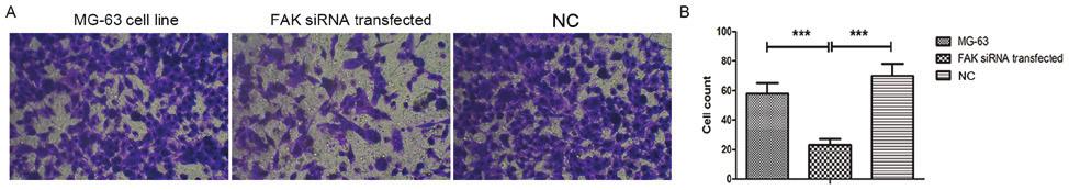 (B) Invasive cell numbers in FAK sirna transfected MG 63 cells were significantly reduced, compared with those in the NC group and untransfected MG 63 cells (P<0.001).