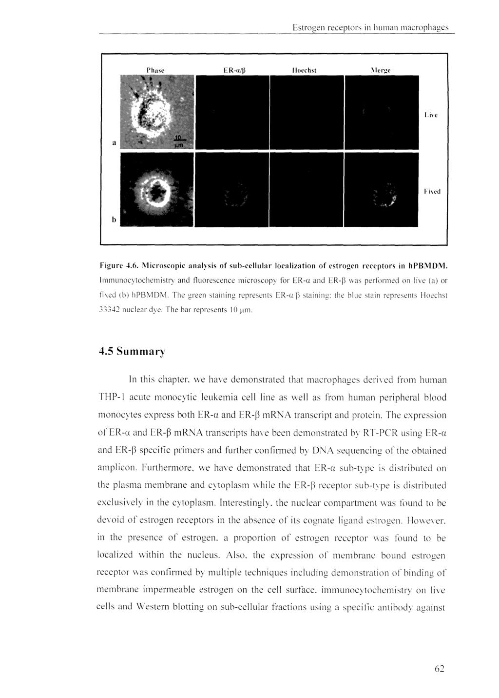 a b Figure 4.6. '\1icroscopic analysis of sub-cellular localization of estrogen receptors in hpb'\1d'\1.