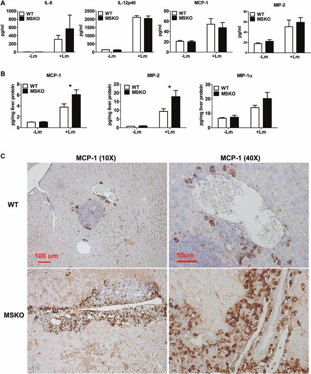Zhu et al ABCA1 and Macrophage Function 1405 Figure 5. Cytokine/chemokine expression in mouse plasma and liver 36 hours after Listeria monocytogenes (Lm) infection.
