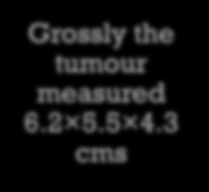 6 cms Grossly the tumour
